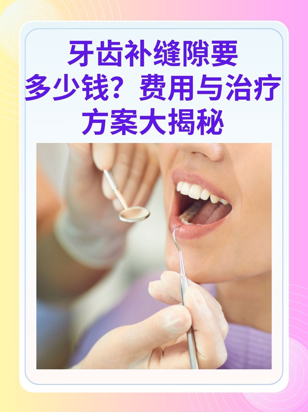 佳木斯补牙医保可以报销吗(补牙医保可以报销吗 哪些可以报销呢)